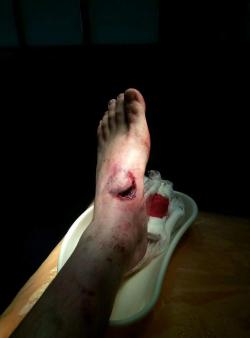 post-9101-0-75277100-1469207621_thumb.jpg